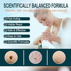Maximum strength salicylic acid gel for corn and callus removal on feet and toes