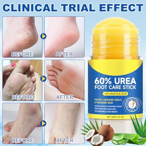 Authentic USA imported Elaimei exfoliating foot care stick for hard calluses