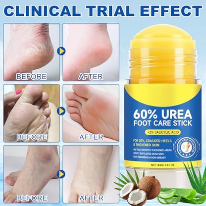 Authentic USA imported Elaimei exfoliating foot care stick for hard calluses