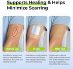 Sterile hypoallergenic burn pads for Indian home first aid kits.