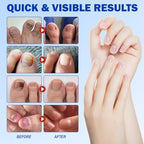 Open box revealing individual single use nail repair patches