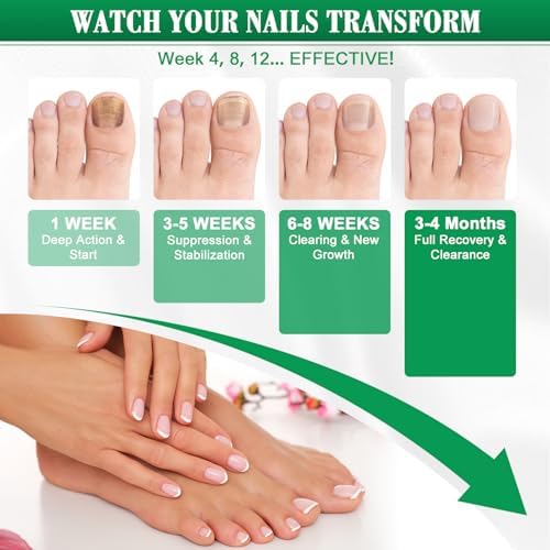 USA imported nail fungus treatment packaging showing extra strength formula details.