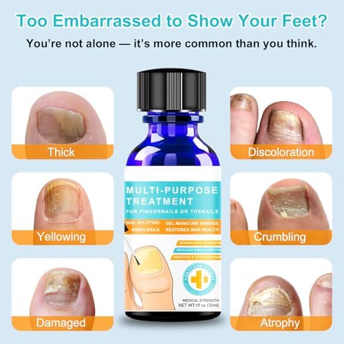 Nail repair solution with precision brush applicator for thick yellow nails