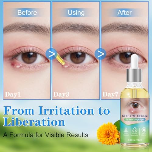 La Personal Stye Eye Relief Serum packaging label details