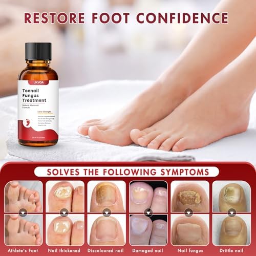 Damaged toenail repair solution with brush applicator for precise use.