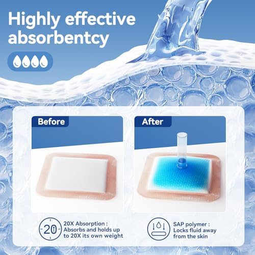 Niceful medical grade silicone dressing showing the multi layer super absorbent polymer core construction