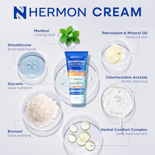 Hermon powerful antifungal cream unboxed lifestyle shot demonstrating proper topical skin application