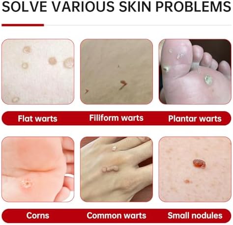 QQE liquid treatment for plantar and flat warts showing clear liquid consistency.