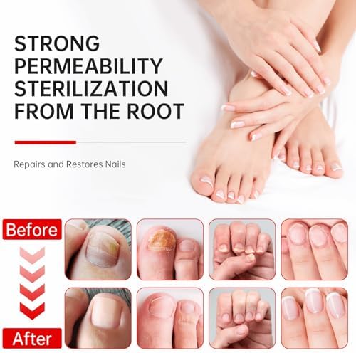 Ingredients list of QQE nail treatment featuring tea tree oil and jojoba oil extracts.