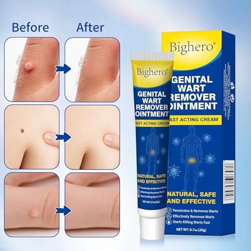 Bighero gel treatment for plantar warts and common warts on hands.