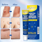 Bighero gel treatment for plantar warts and common warts on hands.