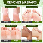 XIWEIOO professional foot care supplies for removing dead skin.