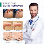 USA imported fast acting liquid corn remover for toes and fingers