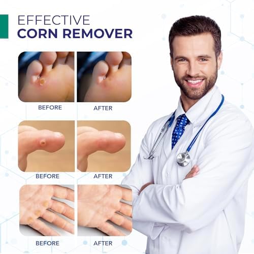 USA imported fast acting liquid corn remover for toes and fingers