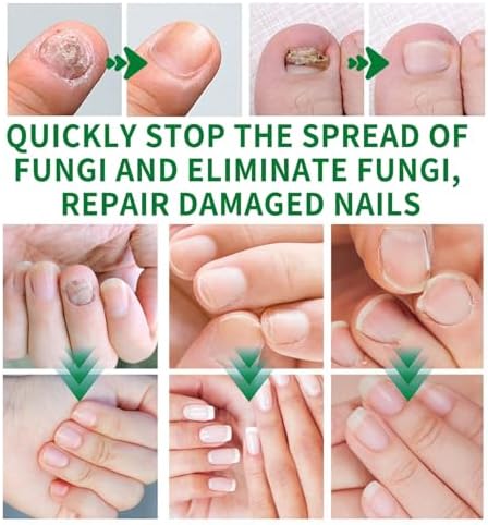 Ginger nail repair liquid providing assistance with 7 day manicure maintenance