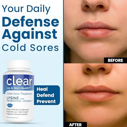 Clear Probiotics Lysine Cold Sore Treatment daily routine usage graphic