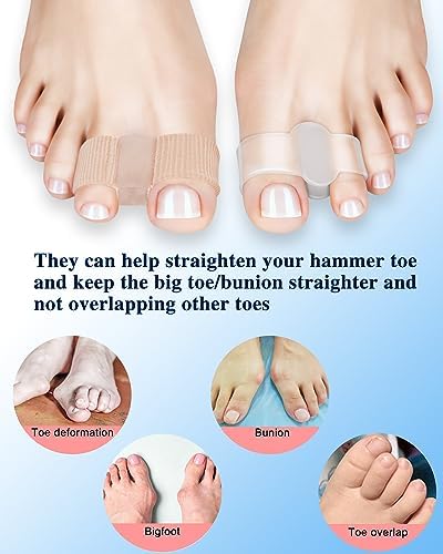 PGRODE bunion corrector kit showing washable and reusable material texture.