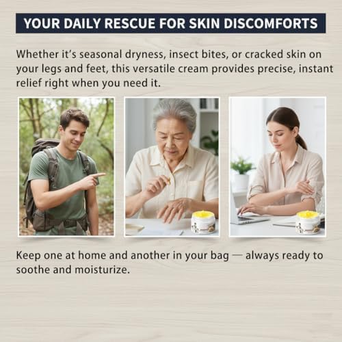 Applying Zimumoda non greasy herbal soothing cream on dry hands