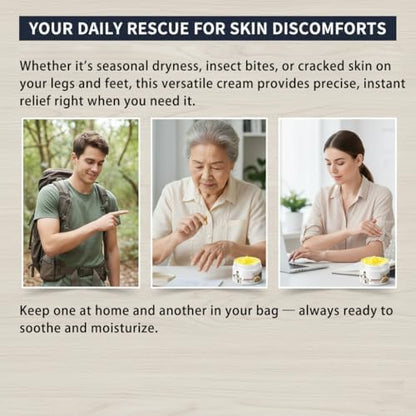 Applying Zimumoda non greasy herbal soothing cream on dry hands