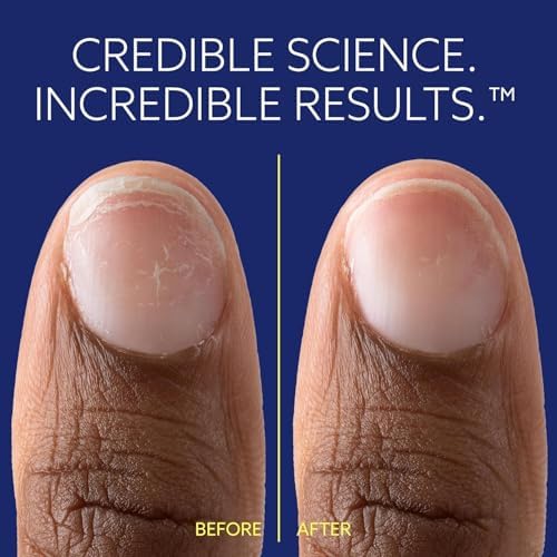 Professional nail repair solution by Epres packaging details