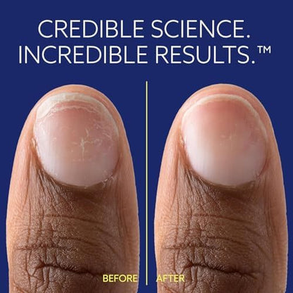 Professional nail repair solution by Epres packaging details