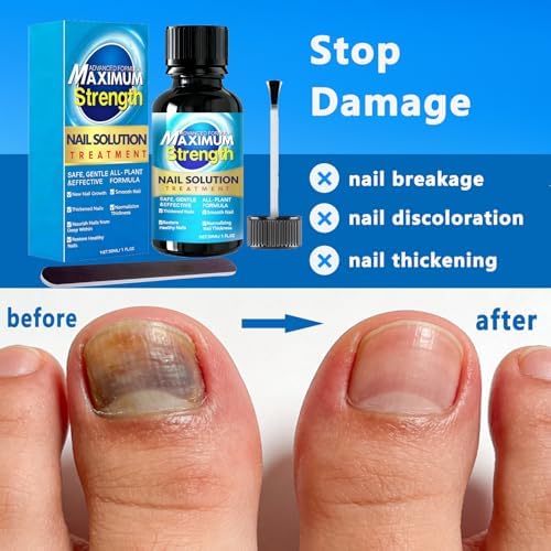 Krrbsr 30ml nail repair liquid packaging highlighting the advanced 1 percent Tolnaftate formula.