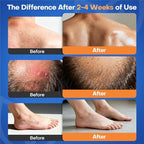 Side view of Seebeellar antifungal cream detailing instructions for seborrheic dermatitis.