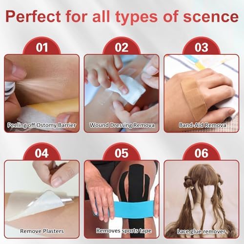 Nosgay medical glue remover spray for ostomy bag barrier care.
