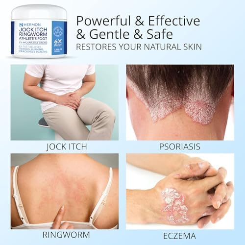 Hermon maximum strength foot and body balm for skin irritation relief