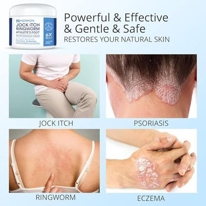 Hermon maximum strength foot and body balm for skin irritation relief