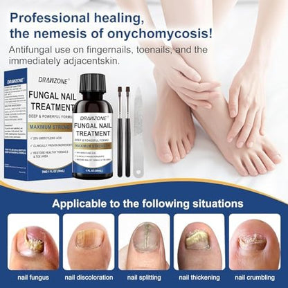 Drawzone extra strength 25 percent undecylenic acid bottles for yellow nails.