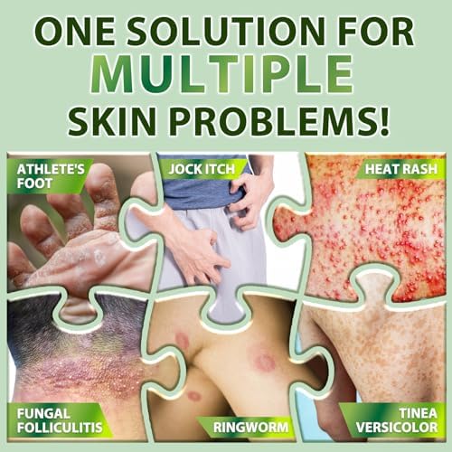 Recuren Plus herbal soothing cream for jock itch and athlete's foot treatment.