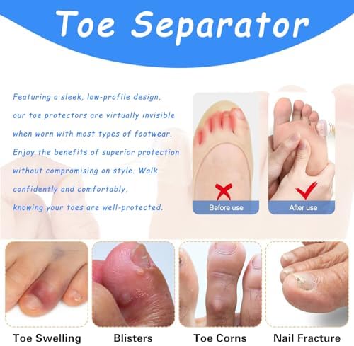 Transparent gel toe covers with breathable ventilation holes for blister protection.