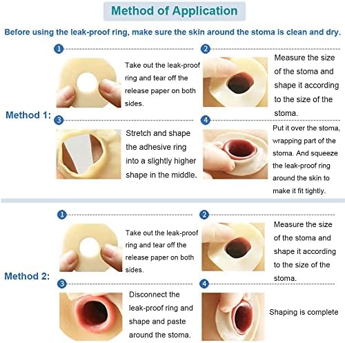 Moldable hydrocolloid barrier extenders for colostomy bags close up view