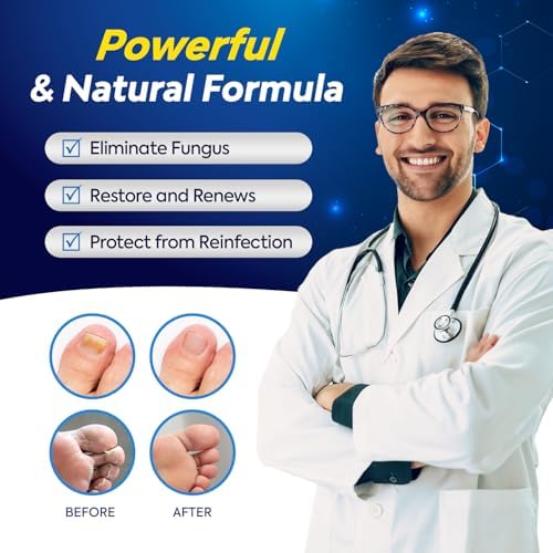 Extra strength 25 percent Undecylenic Acid liquid drops for toe fungus
