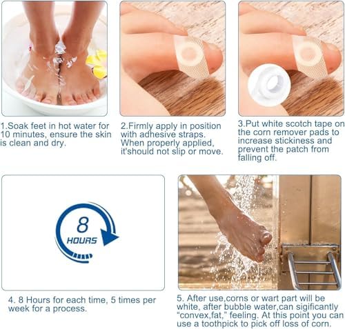 Infographic showing the one-step application process for wart removal.