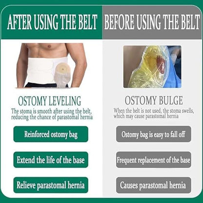 Low profile discreet fit demonstration of the Flosmore parastomal hernia prevention belt