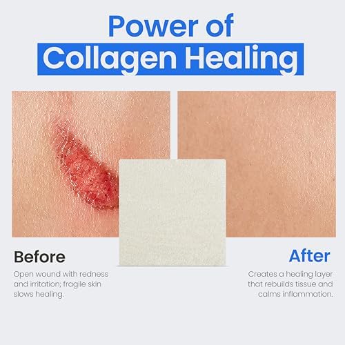 Simpurity sterile collagen dressing pads pack of five showing detailed application instructions and product specs.