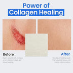 Simpurity sterile collagen dressing pads pack of five showing detailed application instructions and product specs.