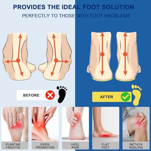Blue and black gel running insoles for flat feet relief and comfort.