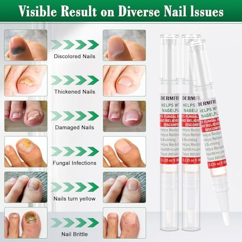 Three pack of antifungal nail repair pens for thick and discolored nails.
