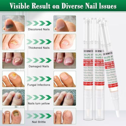 Three pack of antifungal nail repair pens for thick and discolored nails.