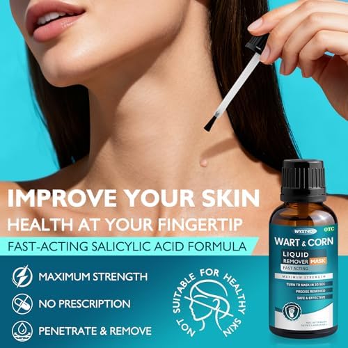 WYXTRO freeze off liquid mask forming on a common wart for precise removal.