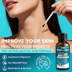 WYXTRO freeze off liquid mask forming on a common wart for precise removal.