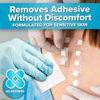 Latex free skin safe adhesive wipes for sensitive stoma care