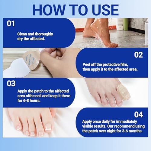 Open box displaying individual breathable nail repair patches