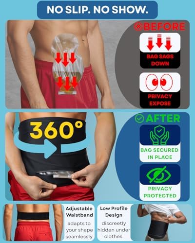 Caredgitz colostomy bag cover showing adjustable velcro strap
