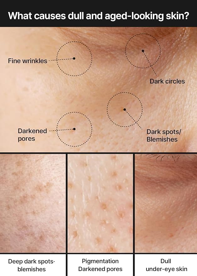 Celimax hyperpigmentation cream tube packaging highlighting barrier repair and deep hydration benefits.