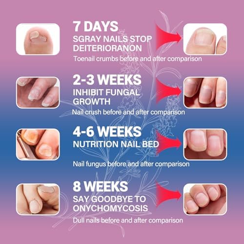 HULEIWA antifungal liquid for discolored and brittle toenails