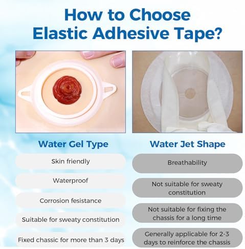 Flexible hydrocolloid perimeter tape application on stoma flange